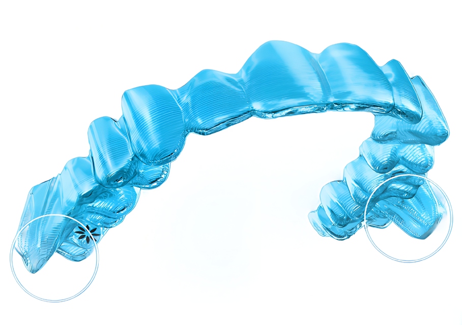Invisalign.jpg